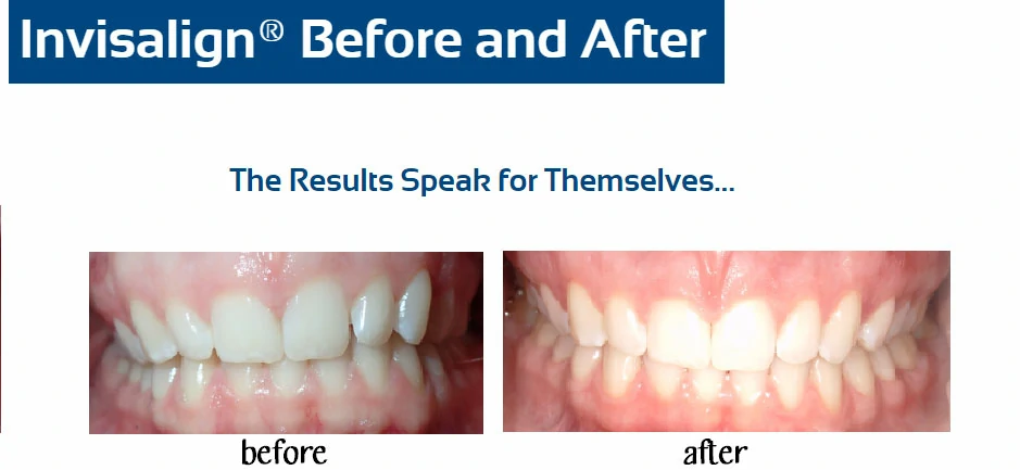 inv-before-after-abigail-boes