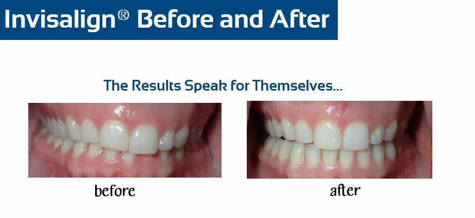 inv-before-after-c-hahn
