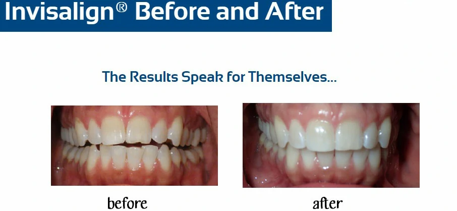 inv-before-after-h-mckernan