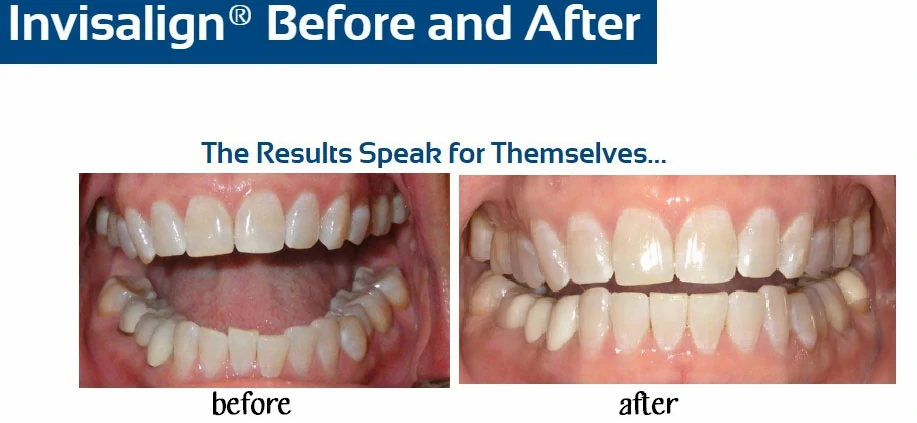 inv-before-after-l-nguyen