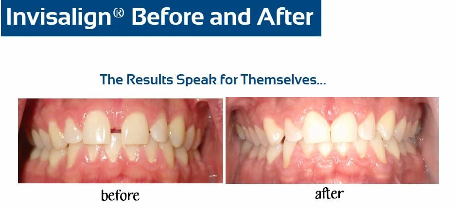 inv-before-after-m-garcia